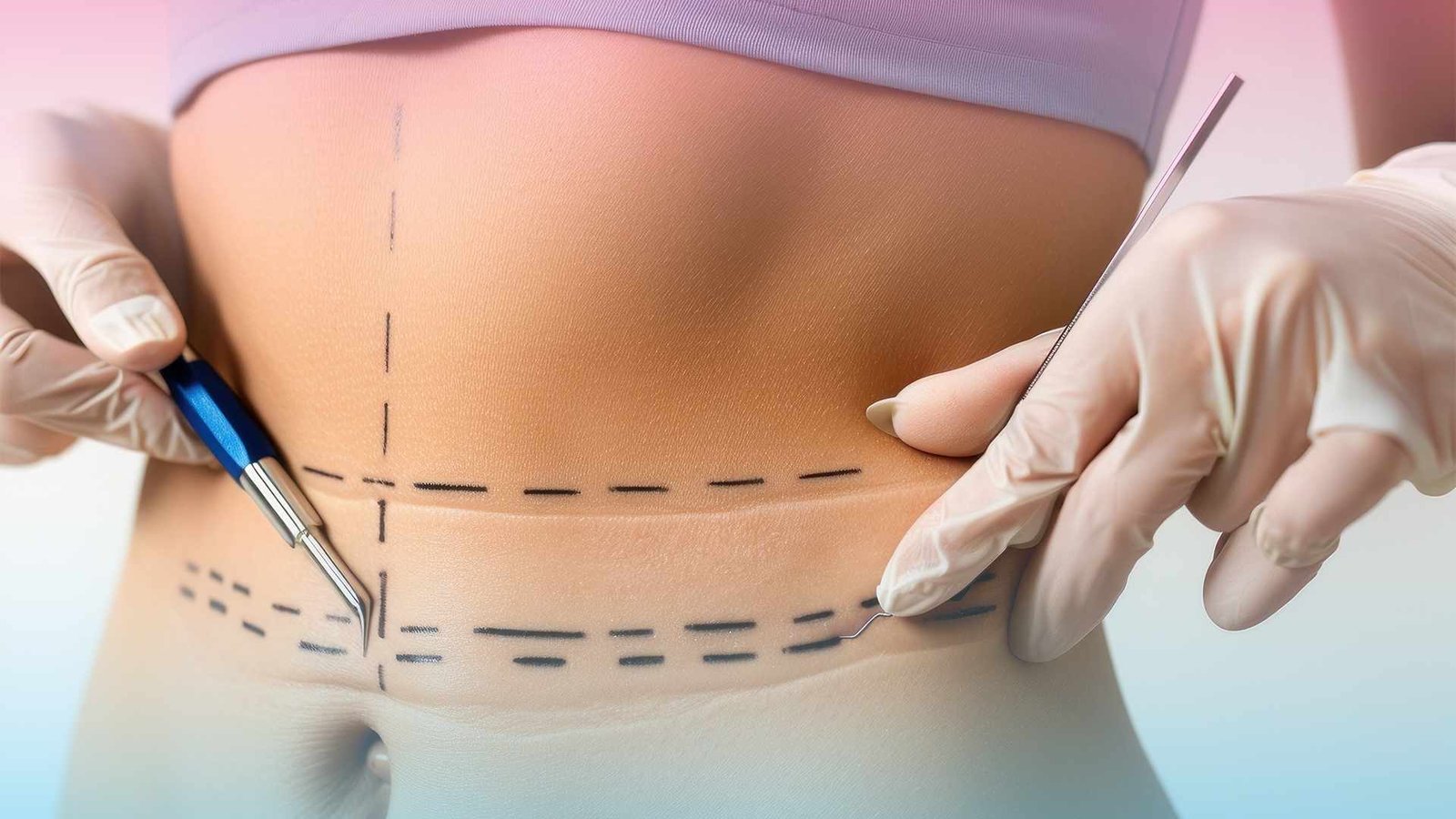 Are you looking for the best place for tummy tuck in Turkey? Aliaesthetic, located in Istanbul...