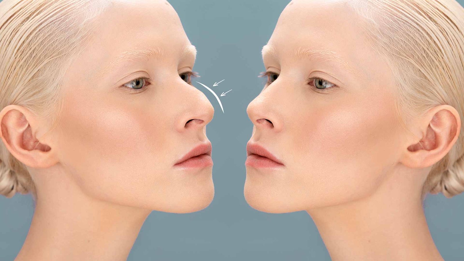 Discover expert services of rhinoplasty in Turkey, Istanbul.