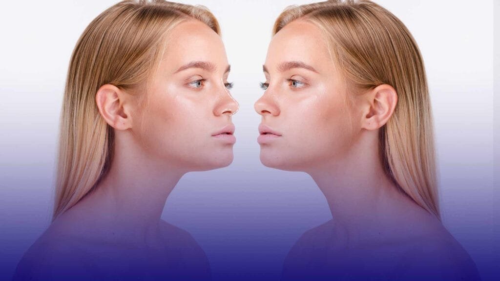 Rhinoplasty in Turkey technology advancements in 2025