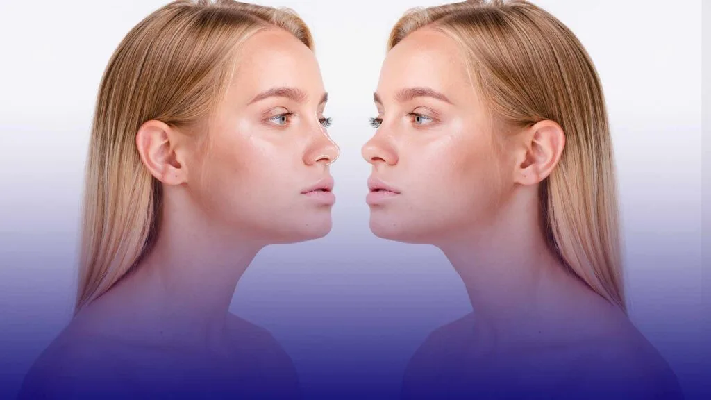 Rhinoplasty in Turkey technology advancements in 2025