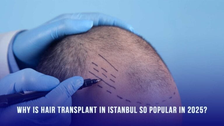 Why is hair transplant in Istanbul so popular in 2025